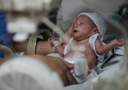 A premature baby in the NICU